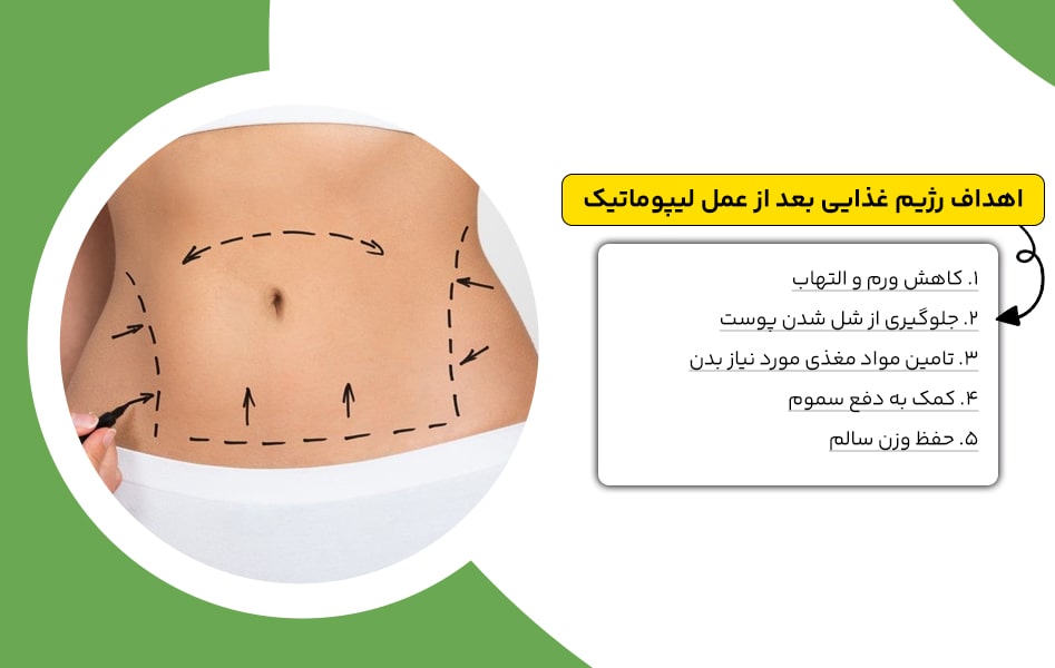 اهداف رژیم غذایی بعد از عمل لیپوماتیک